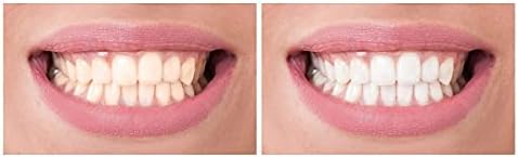 Науки за насмевка - Премиум заби за белење на заби, заби побели и посветло пенкало содржи карбамид пероксид и водород пероксид, без