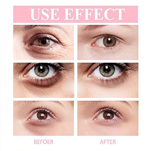 EiaSer Retinol полипептид крем за очи, ретинол крем за очи анти-стареење, Eiaser retinol пептид анти-брчки крем за очи, за целото лице од типот