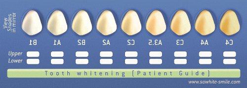 Лесна насмевка-Белење на заби за белење на заби-комплет пар-60cc 35% пероксид карбамид + 4 ленти изработени во САД-