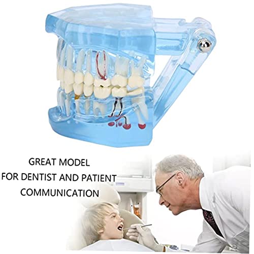 Модел на стоматолошка анатомија - Транспарентен модел на демонстрација и симулација