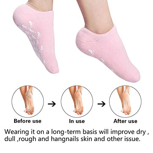 Навлажнувачки Чорапи Пета Гел Чорап-Калус Груб Третман За Нега На Стапала Мек Силиконски Гел Обложен Со Инфузиран Лосион Спа Чорапи|2 Пара Памучни