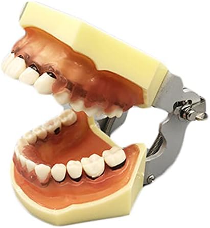 KH66ZKY Пародонтот патолологија Стоматолошка пресметка модел Заби за заби