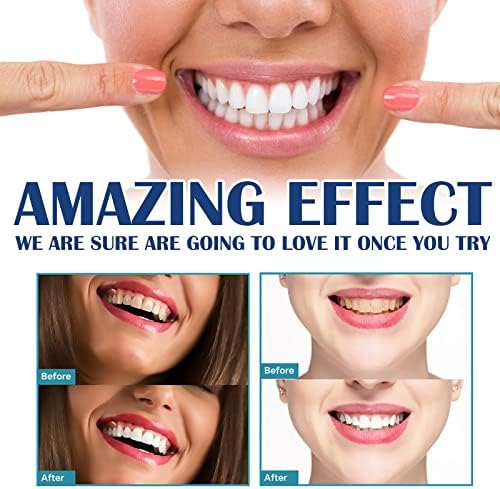 Заби за белење на заби орално чистење и убавина за заби на заби на дамки за заби, нечистотија, жолти заби и белење на заби 5мл
