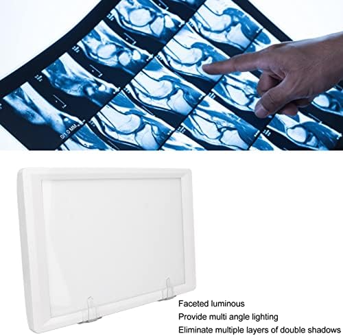 Рентген Дисплеј светилка, Кт Набљудување Светилка, Прилагодете Ја Осветленоста На Бојата и Обликот На Оптички Скенирање Филм За Стоматолошка