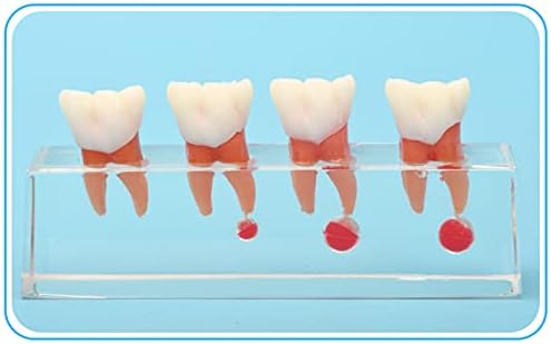 KH66ZKY Стоматолошки заби модел на листопаден модел за реставрација на пулпа Детска студија за настава за стоматолози, снабдува