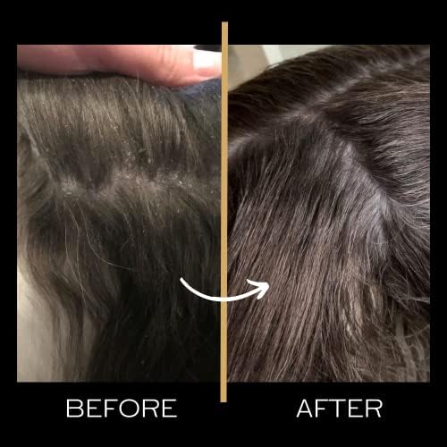 Значи, маслото за завиткување на палтото - го зголемува растот на косата, инстант сјај, нелепливо, без пожолтување, без кршење, длабоко навлажнува за 3 недели силикон