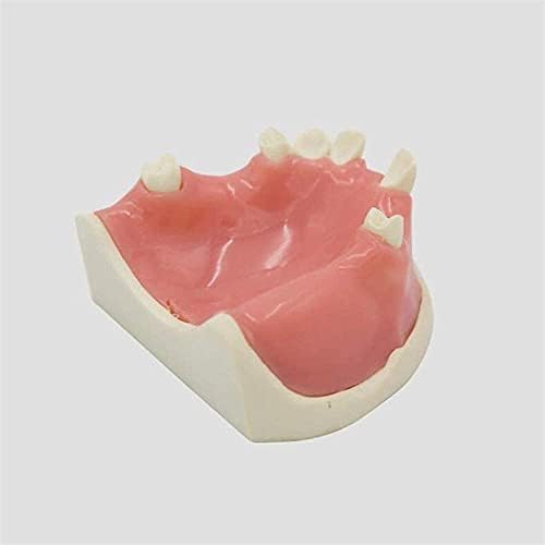 Студиски модел на Наозин-NI Орален модел на заби Максиларен модел на забна имплантација со меки непцата за имплантација на заби