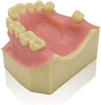 AccDuer Model Model, Model Model Oral Implant Practice Model, Model Model за заби за демонстрација на стоматолошки импланти настава